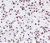 Immunohistochemistry (Formalin/PFA-fixed paraffin-embedded sections) - Anti-ENT2 antibody [EPR11674] (AB181192)