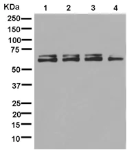 Western blot - Anti-ENT2 antibody [EPR11674] (AB181192)