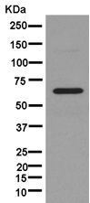 Western blot - Anti-ENT2 antibody [EPR11674] (AB181192), expandable thumbnail