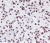 Immunohistochemistry (Formalin/PFA-fixed paraffin-embedded sections) - Anti-ENT2 antibody [EPR11674] - BSA and Azide free (AB231685), expandable thumbnail