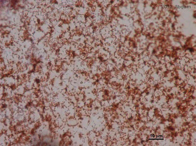 Immunohistochemistry (Formalin/PFA-fixed paraffin-embedded sections) - Anti-Enterococcus antibody (AB19980)