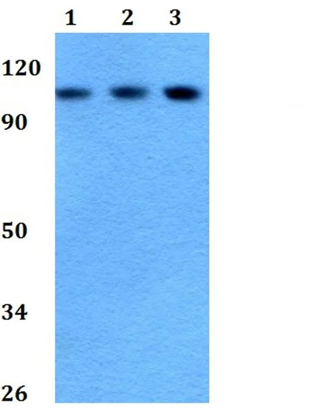 Western blot - Anti-Enterokinase antibody (AB200691)
