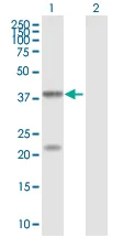 Western blot - Anti-Enterovirus 71 antibody (AB169442)
