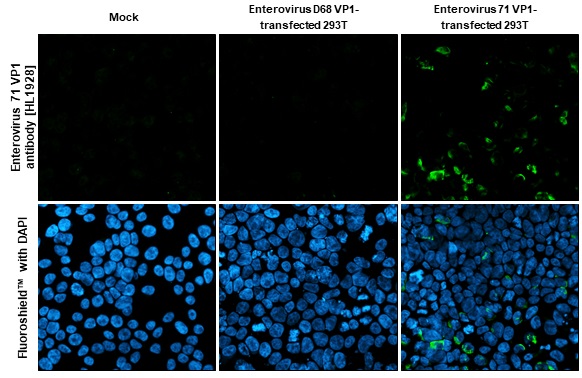 Immunocytochemistry/ Immunofluorescence - Anti-Enterovirus 71 VP1 antibody [HL1928] (AB308205), expandable thumbnail
