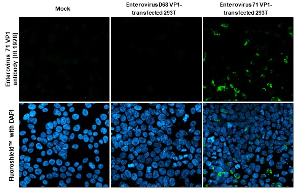Immunocytochemistry/ Immunofluorescence - Anti-Enterovirus 71 VP1 antibody [HL1928] (AB308205)