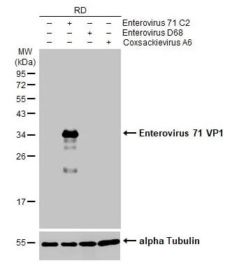 Western blot - Anti-Enterovirus 71 VP1 antibody [HL1928] (AB308205), expandable thumbnail