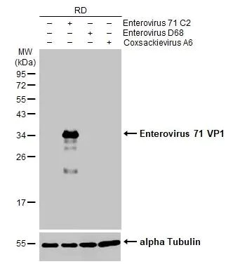 Western blot - Anti-Enterovirus 71 VP1 antibody [HL1928] (AB308205)