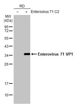 Western blot - Anti-Enterovirus 71 VP1 antibody [HL1928] (AB308205), expandable thumbnail