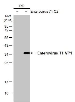 Western blot - Anti-Enterovirus 71 VP1 antibody [HL1928] (AB308205)
