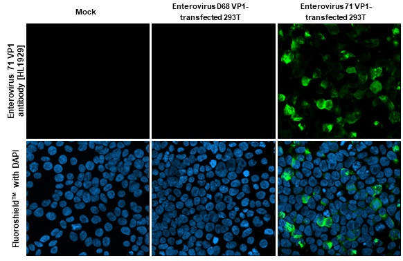 Immunocytochemistry/ Immunofluorescence - Anti-Enterovirus 71 VP1 antibody [HL1929] (AB308206), expandable thumbnail