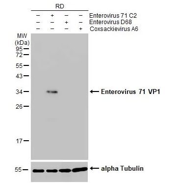 Western blot - Anti-Enterovirus 71 VP1 antibody [HL1929] (AB308206), expandable thumbnail