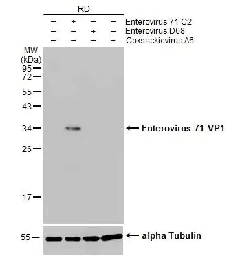 Western blot - Anti-Enterovirus 71 VP1 antibody [HL1929] (AB308206)