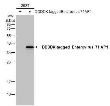 Western blot - Anti-Enterovirus 71 VP1 antibody [HL1929] (AB308206), expandable thumbnail