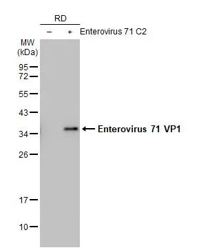 Western blot - Anti-Enterovirus 71 VP1 antibody [HL1929] (AB308206), expandable thumbnail