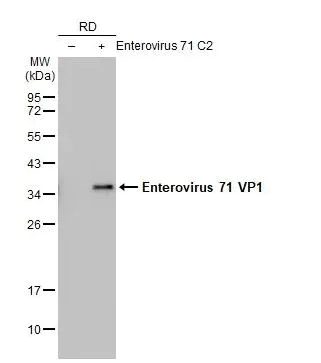 Western blot - Anti-Enterovirus 71 VP1 antibody [HL1929] (AB308206)