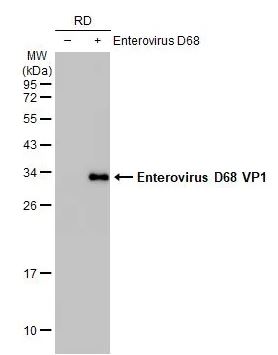 Western blot - Anti-Enterovirus D68 VP1 antibody [HL1997] (AB308217), expandable thumbnail