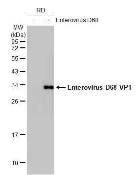 Western blot - Anti-Enterovirus D68 VP1 antibody [HL1997] (AB308217)