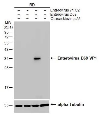 Western blot - Anti-Enterovirus D68 VP1 antibody [HL1997] (AB308217), expandable thumbnail