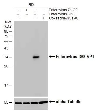 Western blot - Anti-Enterovirus D68 VP1 antibody [HL1997] (AB308217)