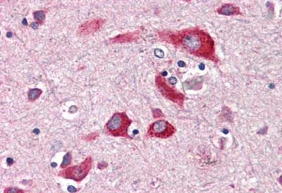 Immunohistochemistry (Formalin/PFA-fixed paraffin-embedded sections) - Anti-ENTPD2 antibody (AB150503)