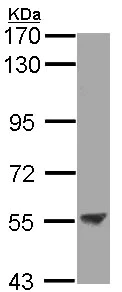 Western blot - Anti-ENTPD3 antibody (AB96335)