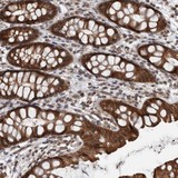 Immunohistochemistry (Formalin/PFA-fixed paraffin-embedded sections) - Anti-ENY2 antibody (AB121836)