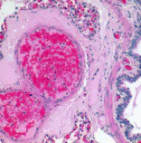 Immunohistochemistry (Formalin/PFA-fixed paraffin-embedded sections) - Eosin Y Solution (Modified Alcoholic) (AB246824)