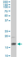 Western blot - Anti-Eosinophil derived neurotoxin antibody (AB103428)