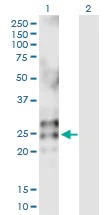Western blot - Anti-Eosinophil derived neurotoxin antibody (AB103428)