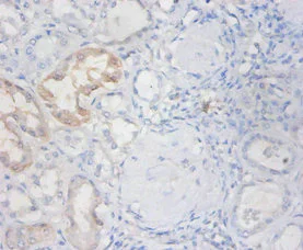 Immunohistochemistry (Formalin/PFA-fixed paraffin-embedded sections) - Anti-Eosinophil derived neurotoxin antibody (AB238562)