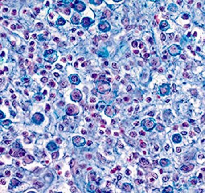 Immunohistochemistry (Formalin/PFA-fixed paraffin-embedded sections) - Eosinophil-Mast Cell Stain Kit (Hematologic Stain) (AB150665), expandable thumbnail