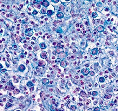 Immunohistochemistry (Formalin/PFA-fixed paraffin-embedded sections) - Eosinophil-Mast Cell Stain Kit (Hematologic Stain) (AB150665)