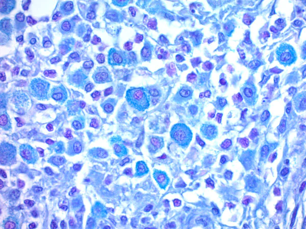 Immunohistochemistry (Formalin/PFA-fixed paraffin-embedded sections) - Eosinophil-Mast Cell Stain Kit (Hematologic Stain) (AB150665)