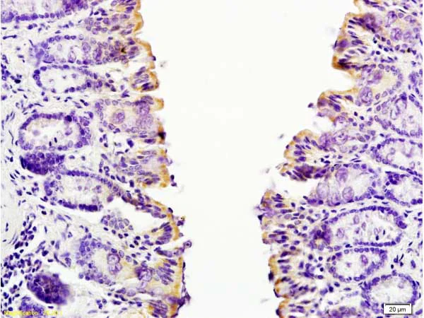 Immunohistochemistry (Formalin/PFA-fixed paraffin-embedded sections) - Anti-Eotaxin 2 antibody (AB203586)