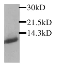 Western blot - Anti-Eotaxin antibody (AB25086)