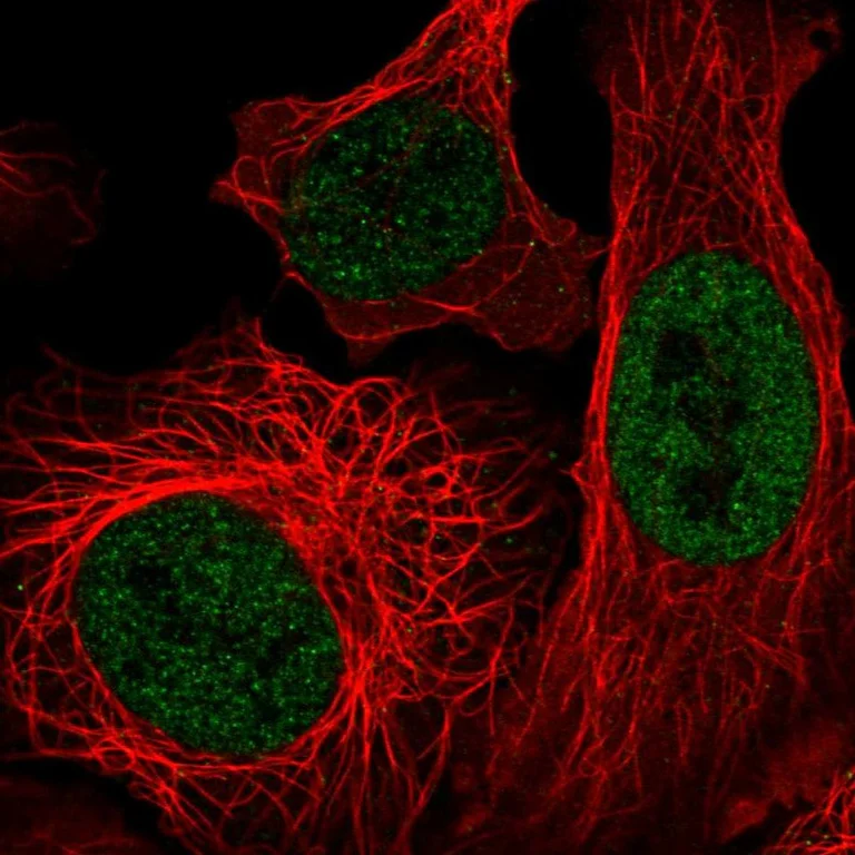 Immunocytochemistry/ Immunofluorescence - Anti-EP400 Antibody (AB327234)