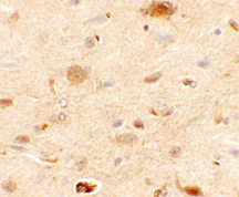 Immunohistochemistry (Formalin/PFA-fixed paraffin-embedded sections) - Anti-Epac1 antibody (AB124162)