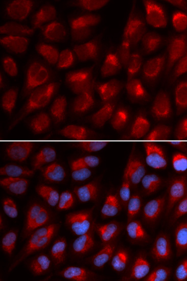 Immunocytochemistry/ Immunofluorescence - Anti-EPB41 antibody (AB185704)