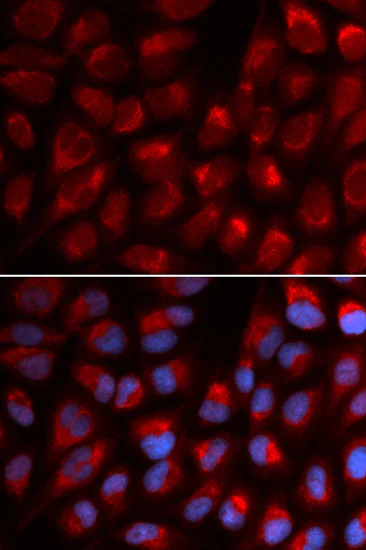 Immunocytochemistry/ Immunofluorescence - Anti-EPB41 antibody (AB185704)