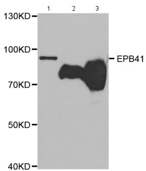 Western blot - Anti-EPB41 antibody (AB185704)