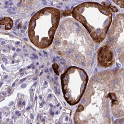 Immunohistochemistry (Formalin/PFA-fixed paraffin-embedded sections) - Anti-EPB41L1 antibody (AB244499), expandable thumbnail