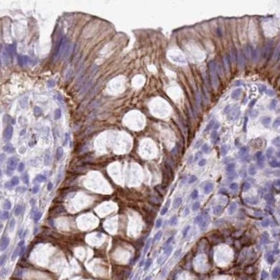Immunohistochemistry (Formalin/PFA-fixed paraffin-embedded sections) - Anti-EPB41L1 antibody (AB244499), expandable thumbnail