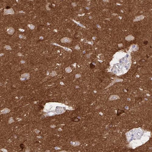Immunohistochemistry (Formalin/PFA-fixed paraffin-embedded sections) - Anti-EPB41L1 antibody (AB244499), expandable thumbnail