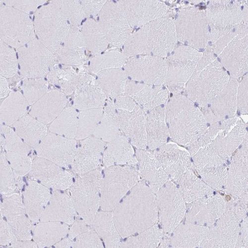 Immunohistochemistry (Formalin/PFA-fixed paraffin-embedded sections) - Anti-EPB41L1 antibody (ab244499), expandable thumbnail