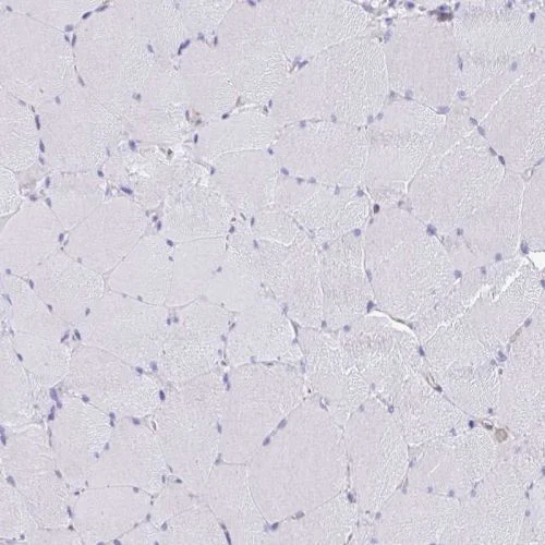 Immunohistochemistry (Formalin/PFA-fixed paraffin-embedded sections) - Anti-EPB41L1 antibody (AB244499)