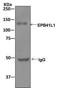 Immunoprecipitation - Anti-EPB41L1 antibody [EPR11090] (AB179453)