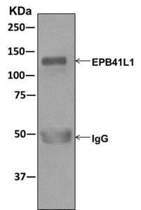 Immunoprecipitation - Anti-EPB41L1 antibody [EPR11091] - BSA and Azide free (AB250115)
