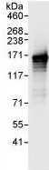 Immunoprecipitation - Anti-EPB41L2 antibody (AB99375)
