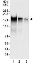 Western blot - Anti-EPB41L2 antibody (AB99375)