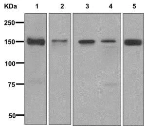 Western blot - Anti-EPB41L2 antibody [EPR8873(2)] (AB175928)